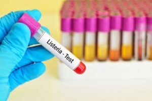 Caz de listerioză confirmat în județul Brăila