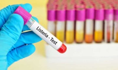 Caz de listerioză confirmat în județul Brăila